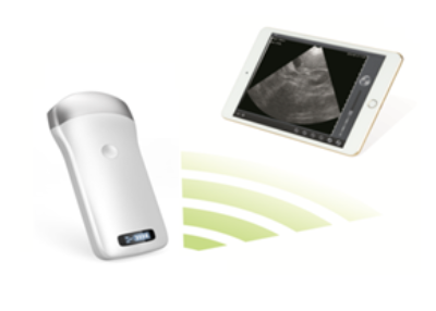 WIRELESS USG - Ultralydapparat